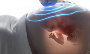 Что такое допплер-УЗИ при беременности, зачем и как его делают?